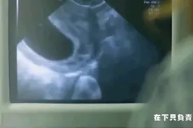 老公带老婆做B超，看到图像时直接懵逼了视频封面