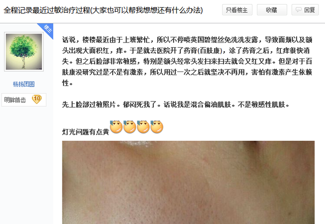 不用激素产品就不会得皮炎？｜你真的会挑选洗面奶吗？