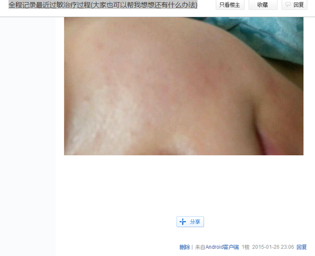 不用激素产品就不会得皮炎？｜你真的会挑选洗面奶吗？