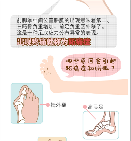 骨科专家:"脚垫"疼痛反复来究竟是什么情况?原来是这种病!