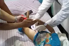 尿道下裂的发病原因有哪些？怎么知道是遗传的还是其他原因呢？视频封面