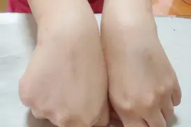 晒黑了怎么办？睡前抹点常喝的它，3天让你晒黑的皮肤白回来