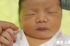 宝宝出黄疸，宝妈不用慌，传统中医秘方当天见效，只需3天就好！视频封面