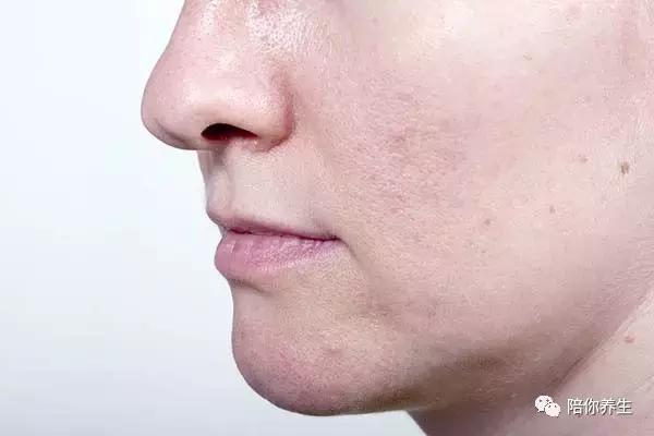 鑴镐笂鐨勯粦鑹茬礌鎬庝箞鍘绘帀 娣℃枒缇庣櫧灏忓鎷涙垜鏉ュ憡璇変綘