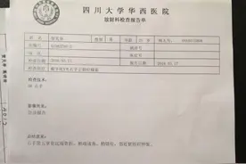 曝贺天举右手第五掌骨远端骨折 并带有错位现象图片