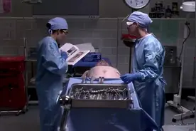 男子的肚子越来越大，做腹积水手术后无故死亡，医生秘密解剖尸体视频封面