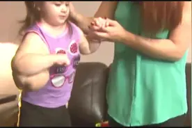 18个月大女婴基因突变成畸形人，胳膊肿大如缩小版绿巨人视频封面