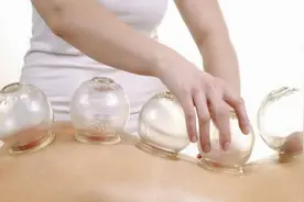 背部拔火罐的好处 背部拔火罐拔哪里图片