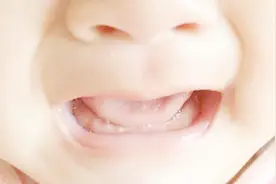 宝宝牙槽上出现了黄白色的小点，是不是感染了？需不需要去医院？