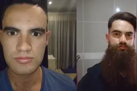 男子记录一年不刮胡子的过程，最后胡子太多连呼吸都不顺畅了！视频封面