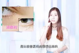 千万别挤！脸部脂肪粒和油脂粒祛除方法公开，简单不留疤！视频封面