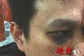 纽约华裔外卖郎遭非裔顾客殴打 冀用法律讨公道图片