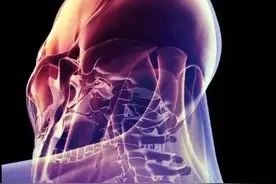 拯救“低头族”之难忍的头痛图片