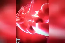 实拍记录胎儿在肚子里各周模样视频封面
