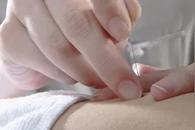 针灸能治疗腰肌劳损吗？通常针灸哪几个穴位呢？