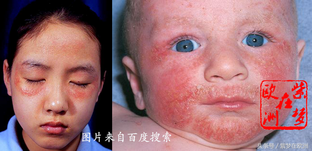 牛栏氨基酸奶粉详解