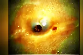 超大黑头被挖出，挖出来那刻感到神清气爽！图片