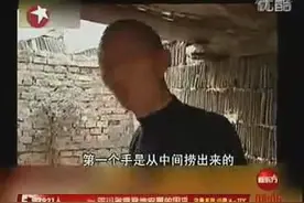 震惊！八岁可爱男孩被养母剁下双手(附视频)图片