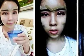 00后少女整容变成蛇精脸的前后大对比，吓得下巴都掉了