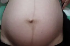 孕15周 这些病症 能猜出是男是女吗？图片