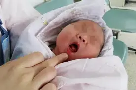 新生儿为何长“马牙”？给孕妈们敲响警钟！图片