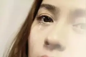 泪水太多,或是患上眼病的信号图片