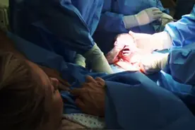 实拍胎儿剖腹产过程，“捧在手里怕摔了，含在嘴里怕化了”！图片