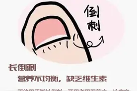 宝宝小小指甲，隐藏健康大秘密！（指甲发出的求救信号...）图片