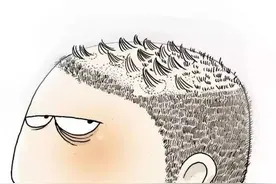 头皮上的银屑病怎么破？图片