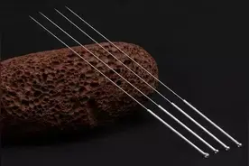 针刺单穴治急症疗效良好图片
