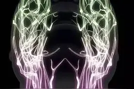 都说春风拂面，可面瘫病人却多了，这是怎么回事?图片