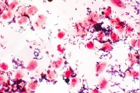 念球菌感染居然会导致这些严重的疾病，我们都在跟它打交道视频封面