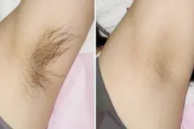 农村姑娘教你自制纯天然脱毛膏，成本才3毛，持久脱毛不反弹视频封面