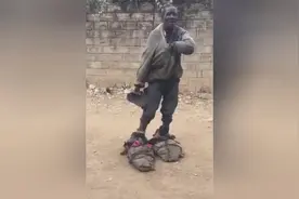 非洲奇葩多，这么大的脚，你是怎么长的？视频封面