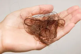 头发总是一掉一大把？别担心，每天吃这个食物让你告别脱发！