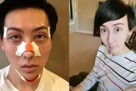 “网红”蛇精男自称是日俄混血 网友：你是p图和整容的混血图片