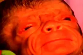 婴儿患有早衰症，出生遍布皱纹，还长有黑色长毛！视频封面