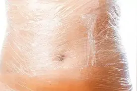 保鲜膜裹肚子减肥？你可能不知道它的危险图片