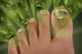 解决脚臭问题，按这几个穴位就可以了图片