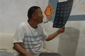 “丢肾”事件检查结果为右肾萎缩 当事人仍存疑问图片
