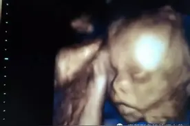 孕育课堂：怀孕三十三周 胎儿发育与孕妈变化图片