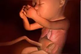 宝宝出生就患缺氧性脑病，医生的解释让你意识到自己错得有多离谱图片