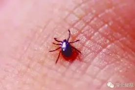 震惊！武汉婆婆手臂长“会移动的黑痣”险丧命，竟然是它作怪图片