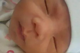 孕妈顺产不会用力，初生宝宝羊水竟呛到肺里！图片