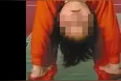 震惊，6岁女孩练舞致截瘫！这个动作千万别让孩子做！图片