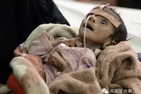 一张震世的照片背后，也门30万儿童濒临着死亡。一切的祸因，皆战争图片