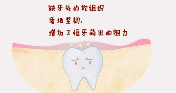 牙龈角化不良