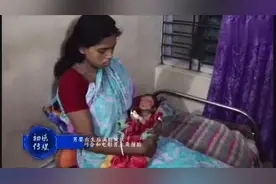 男婴出生后满脸皱纹 像八旬老头视频封面