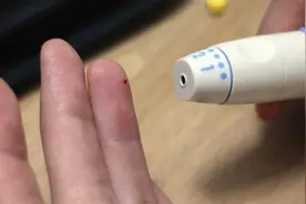 艾滋病患者的四大检测法图片