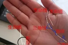 三角纹好不好，看长在哪里，一种有财，一种有疾病